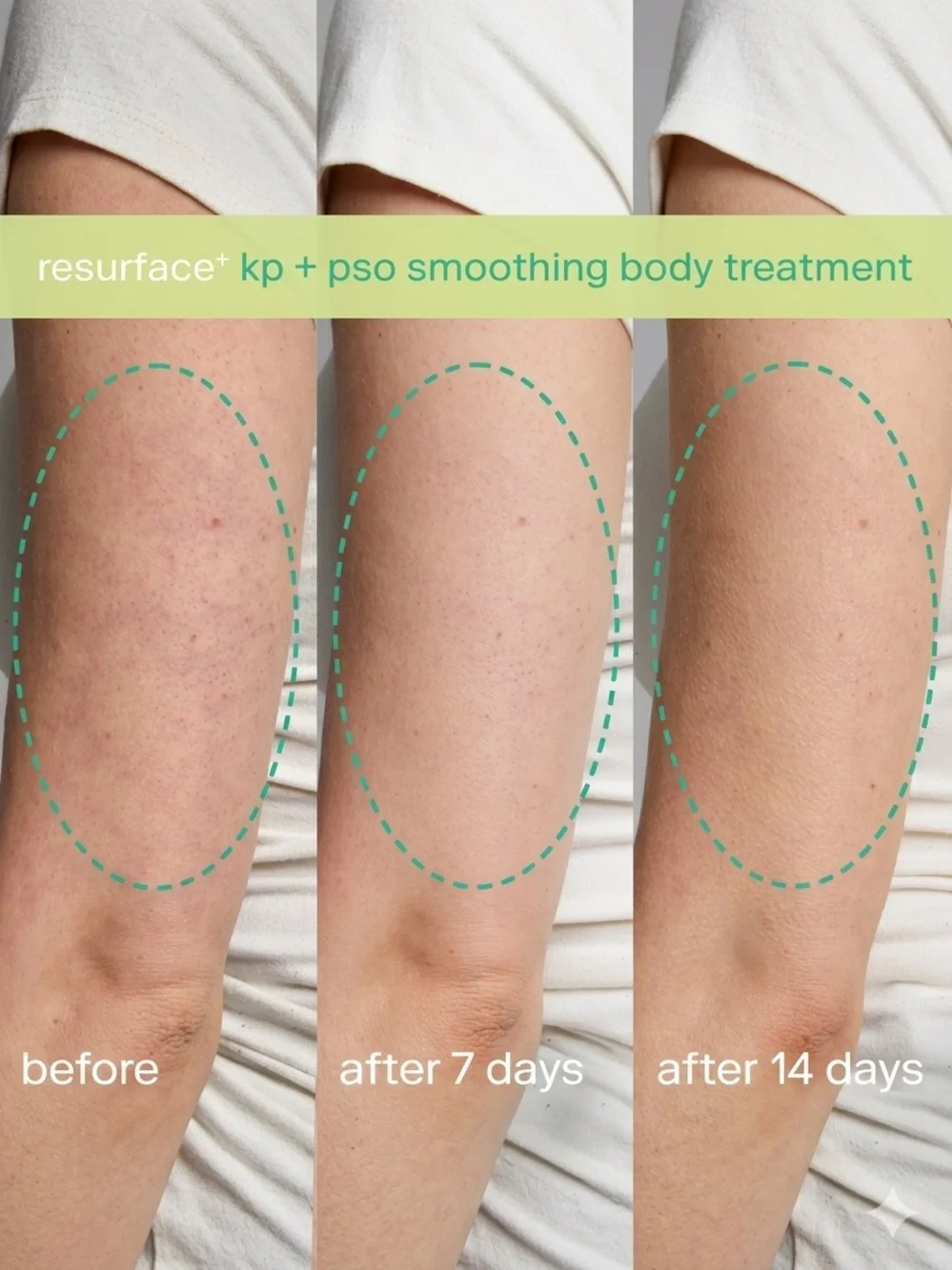 Skinfix Resurface+ Glycolic Renewing Scrub 8 oz New Exfoliator KP Treatment NIB - Picture 8 of 8